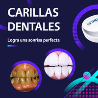 Carillas dentales