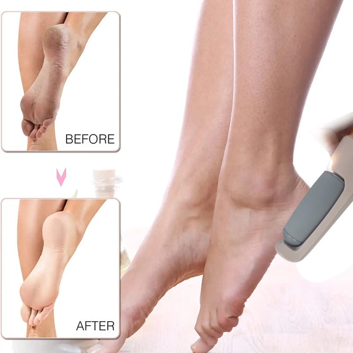 Pedicure electronico 🦶