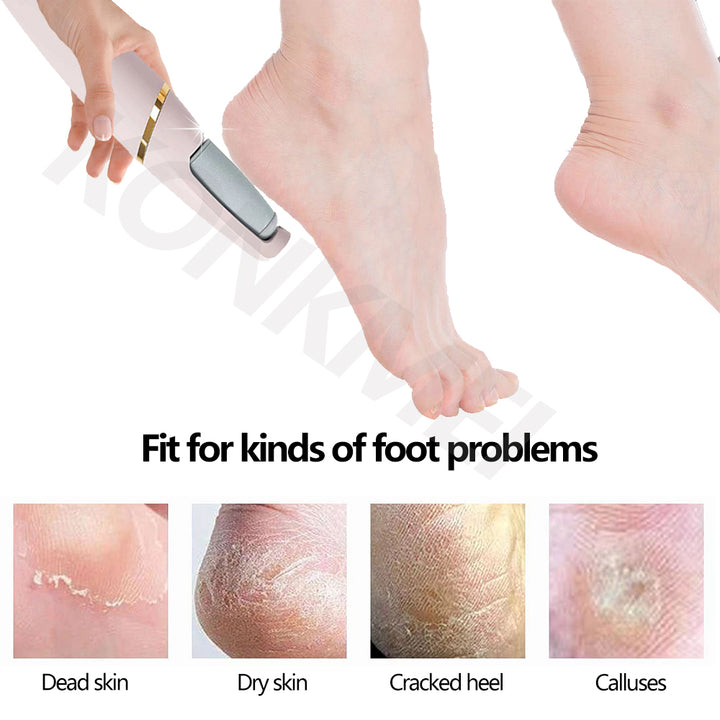 Pedicure electronico 🦶