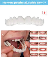Carillas dentales
