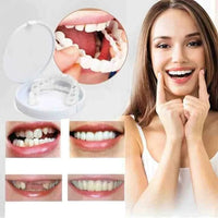 Carillas dentales