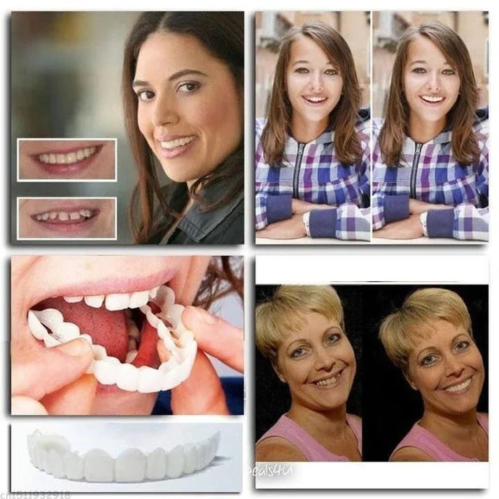 Carillas dentales